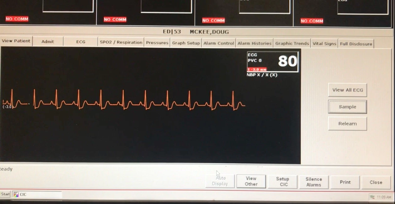 Patient monitor display showing simulated ECG waveform and vital signs active after ECG simulator connection